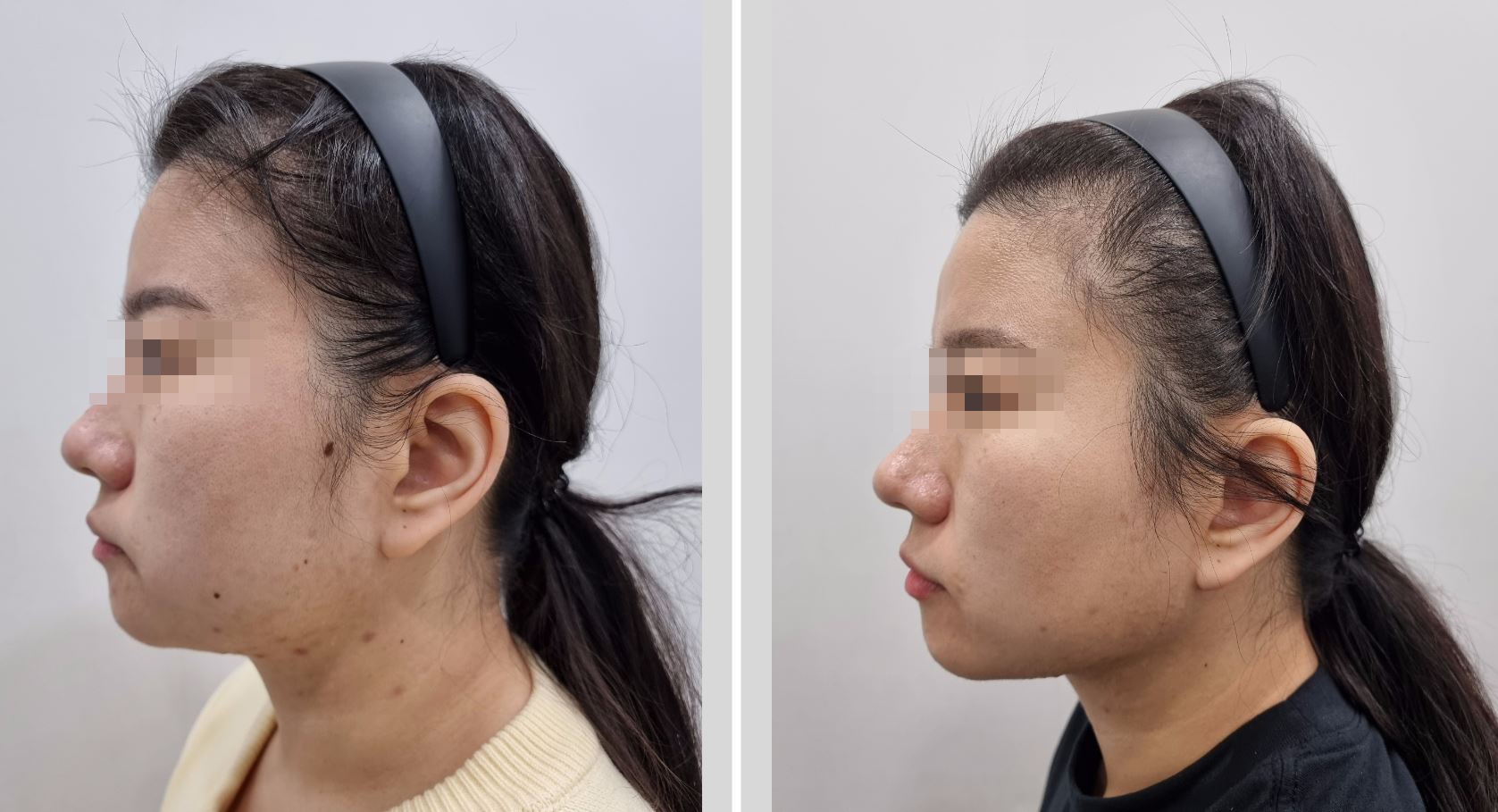 박혜미