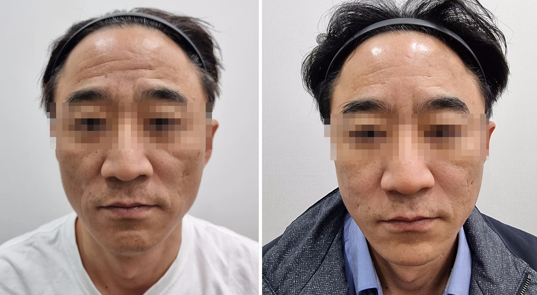 쥬볼_이영준